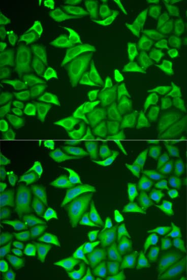 NGB / Neuroglobin Antibody