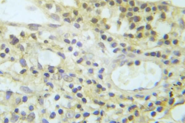 Polyclonal Rabbit anti-Human AKT1 + AKT2 + AKT3 Antibody (phospho-Tyr326, IHC)