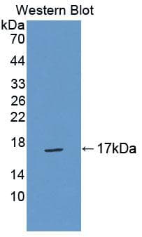TP-2 / TNP2 Antibody (aa1-117, PE)