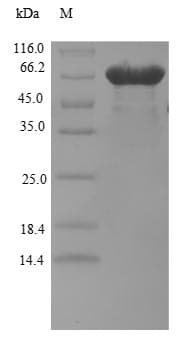 Human BZW2 Protein (Recombinant 6His, N-terminus)