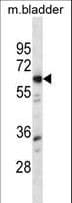 LYN Antibody (aa1-30)