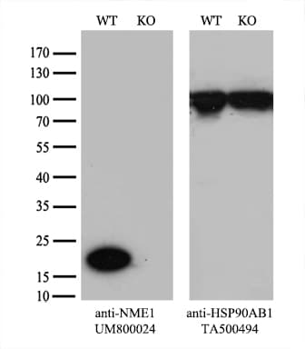 Monoclonal Mouse anti-Human NME1 / NM23 Antibody (clone UMAB93, IHC, IF, WB)