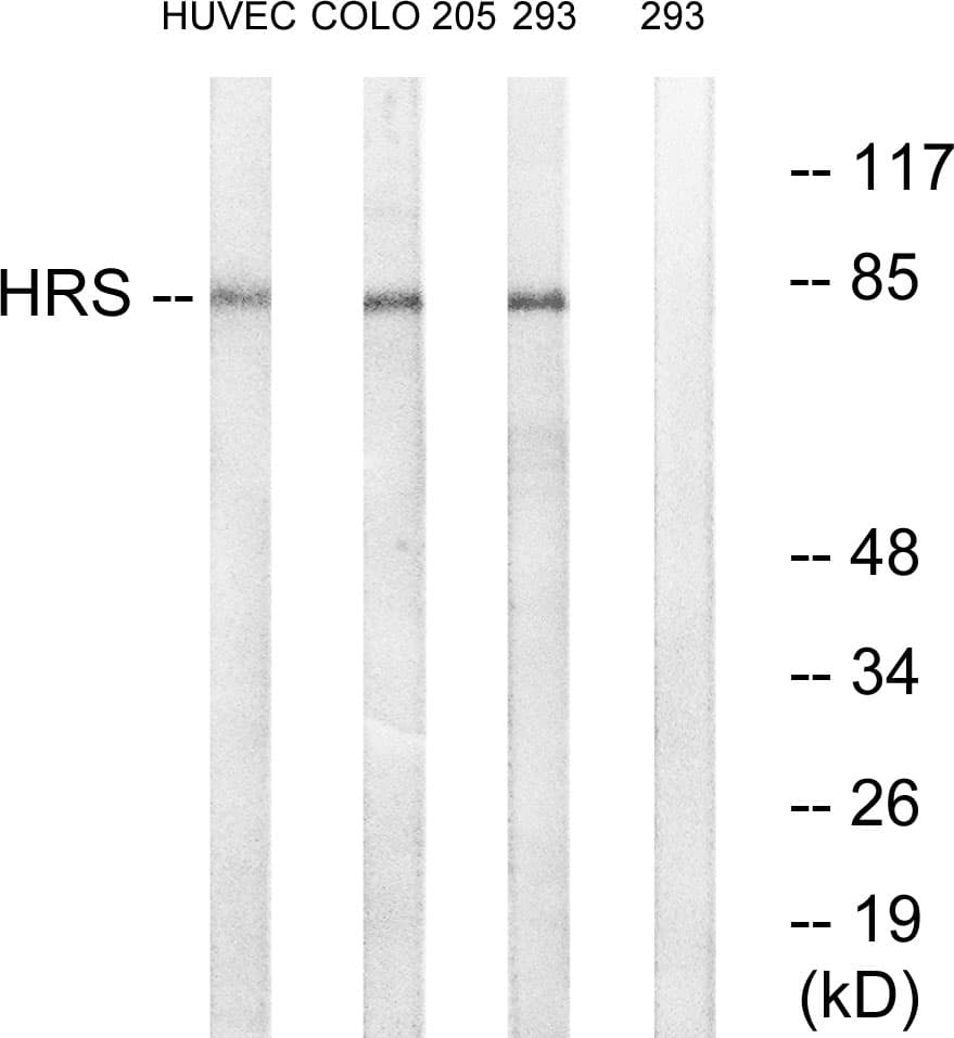 HRS / HGS Antibody (aa301-350)