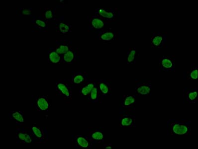 Polyclonal Rabbit anti-Human HIST1H3A Antibody (IF)