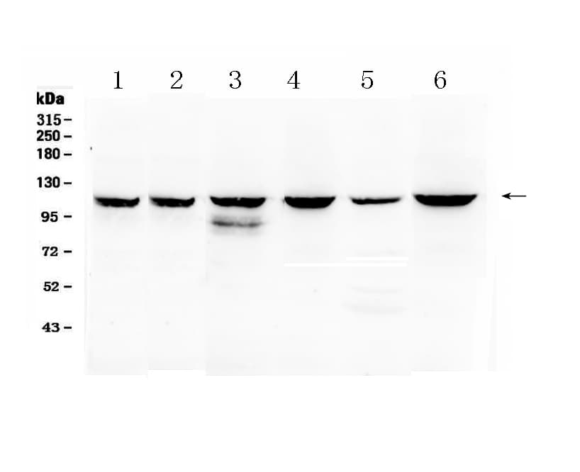 PIK3CB / PI3K Beta Antibody