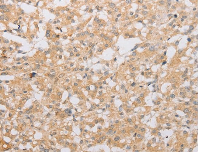 ATG9A Antibody