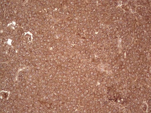 UBE2D2 / UBCH5B Antibody (clone OTI1D11)