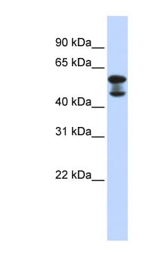 Polyclonal Rabbit anti-Human EHD4 Antibody (aa360-409, WB)