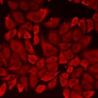 PKD3 / PRKD3 Antibody