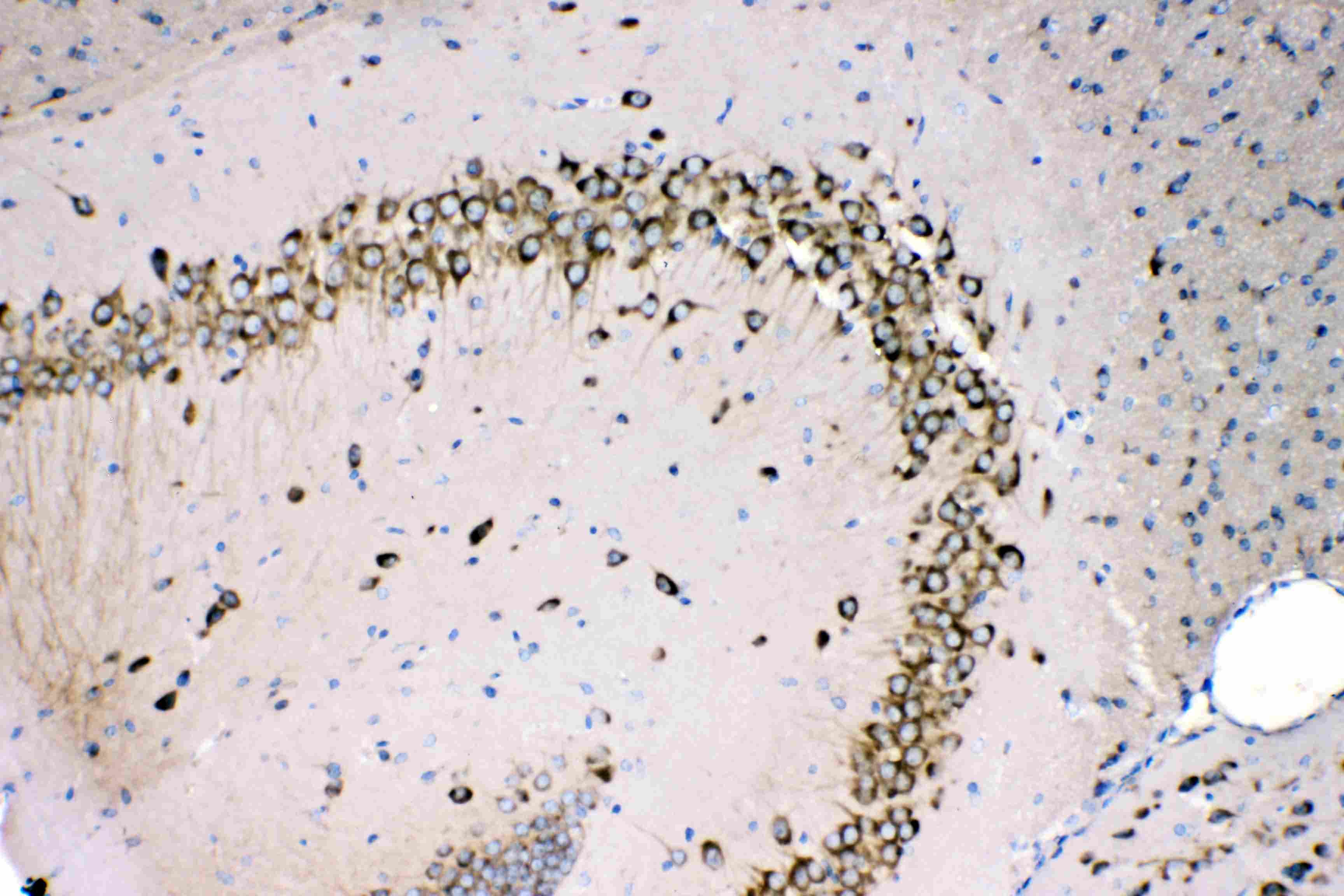 Polyclonal Rabbit anti-Human RPS27 / Ribosomal Protein S27 Antibody (IHC, WB)