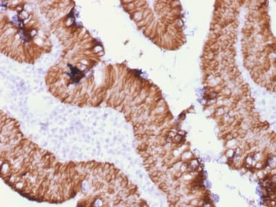 Recombinant Monoclonal Mouse anti-Human EPCAM Antibody (clone rEGP40/1372, aa77-202, IHC, WB)