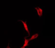 Polyclonal Rabbit anti-Human KIF11 / EG5 Antibody (IF, WB)