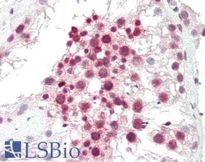 IHC-plus™ TRIM69 / Trif Antibody (aa101-129)