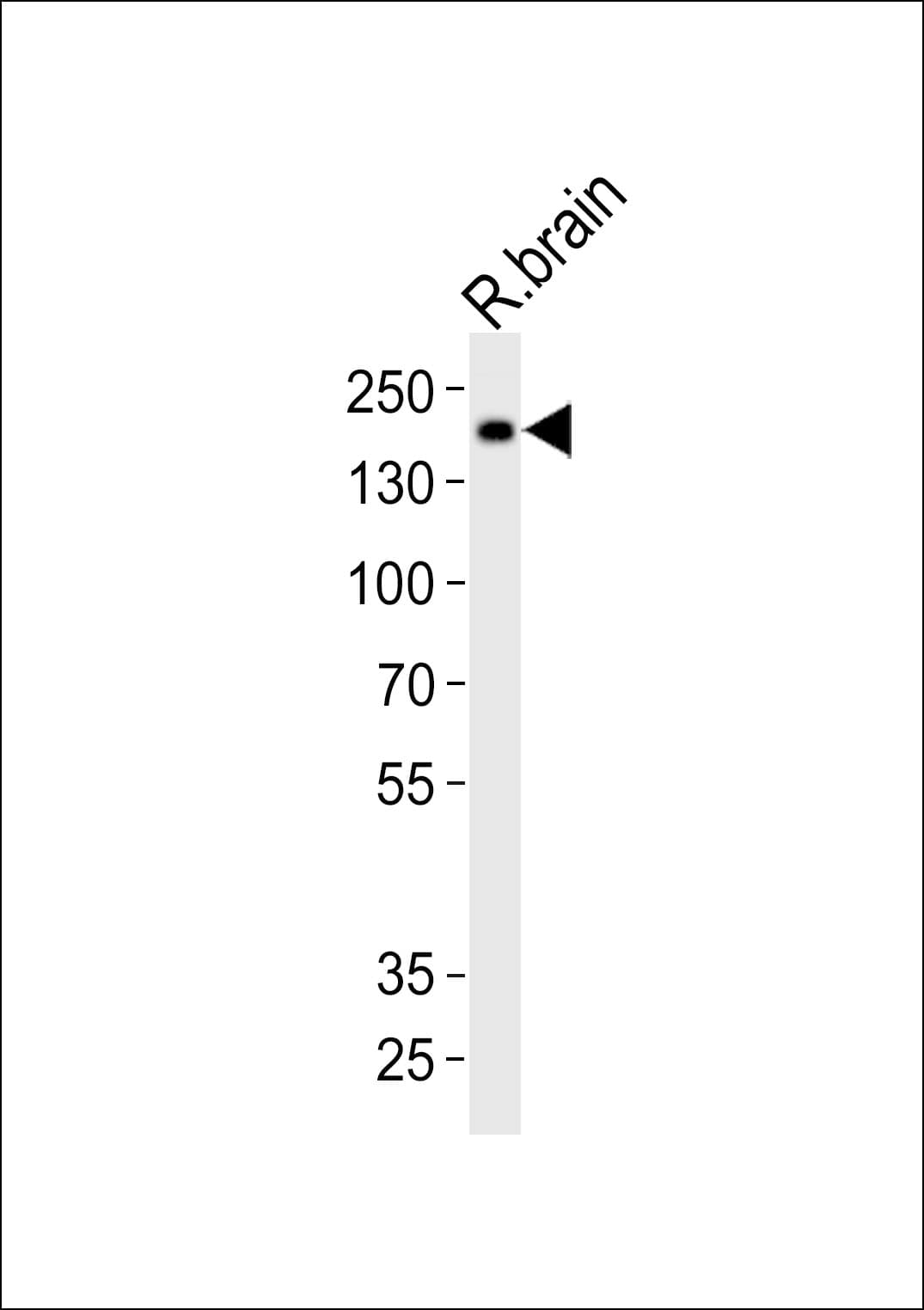 INSRR Antibody (aa1295-1289)