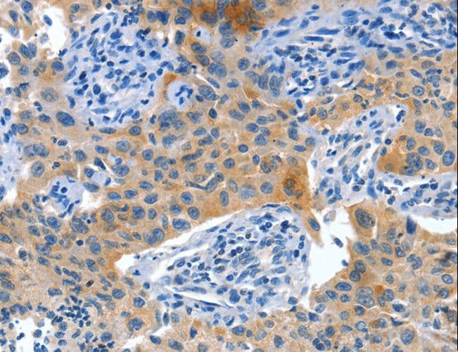 PLAP / Alkaline Phosphatase Antibody
