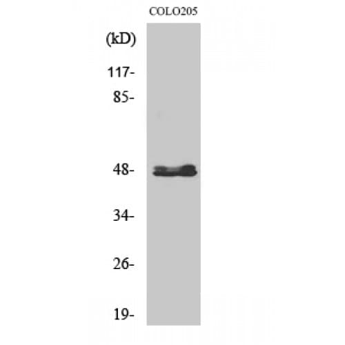 CYP11B1+2 Antibody (C-terminal)