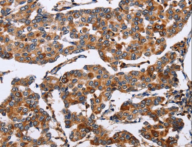 ENPP5 Antibody