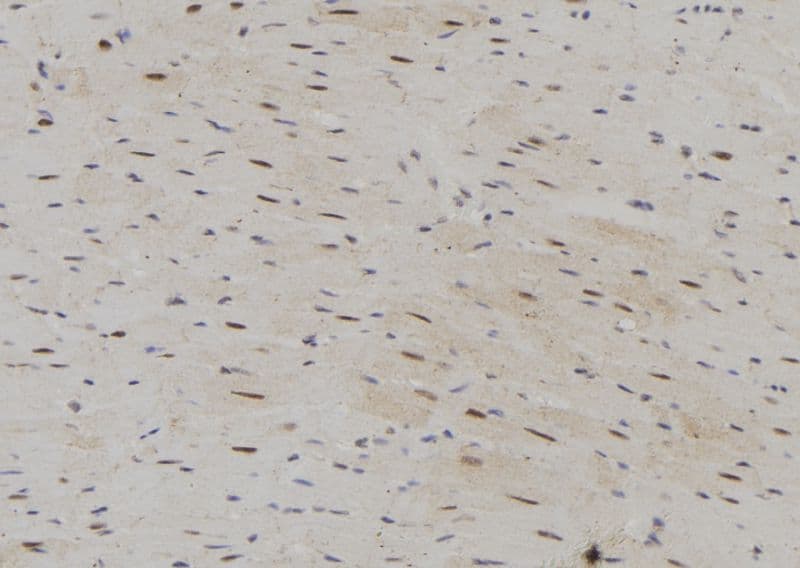 SRP68 Antibody