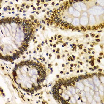 LMNA / Lamin A+C Antibody