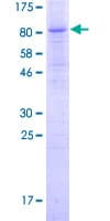 Human C6orf150 / MB21D1 Protein (Recombinant GST, N-terminus)