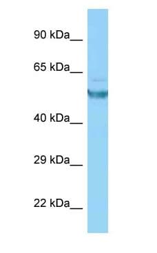 CAMK2G / CaMK II Gamma Antibody (aa311-360, Biotin)