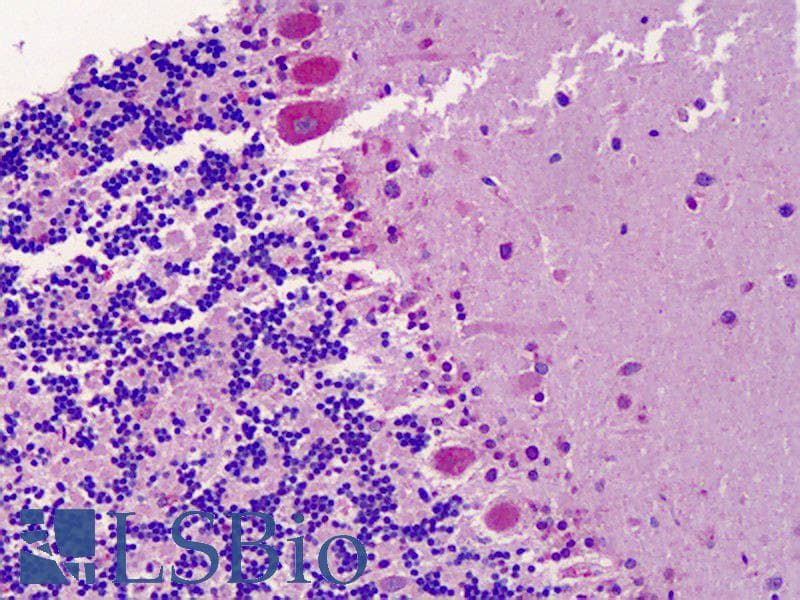 IHC-plus™ Polyclonal Rabbit anti-Human ACKR3 / CXCR7 Antibody (aa311-360, IHC, IF, WB)