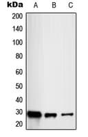 RAB20 Antibody (Internal)