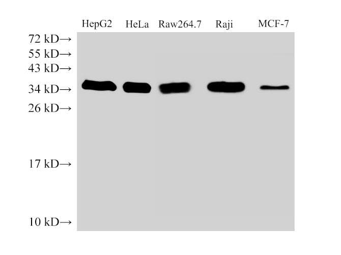 Polyclonal Rabbit anti-Human PCNA Antibody (IHC, WB)