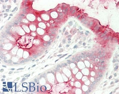 IHC-plus™ Monoclonal Mouse anti-Human CEACAM5 / CD66e Antibody (clone 26/3/13, IHC, WB)