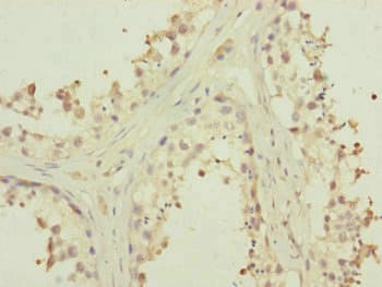Polyclonal Rabbit anti-Human MTERF2 / MTERFD3 Antibody (IHC, WB)