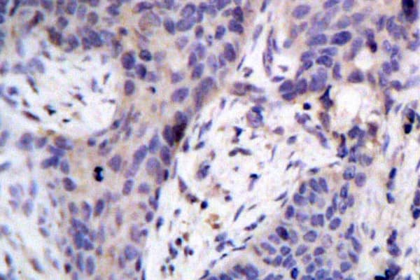 Polyclonal Rabbit anti-Human BAD Antibody (Phe130, IHC, WB)