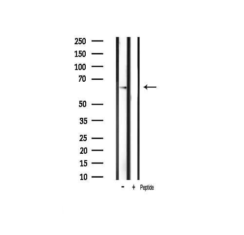 Polyclonal Rabbit anti-Human PAK1 Antibody (phospho-Thr212, IHC, IF, WB)