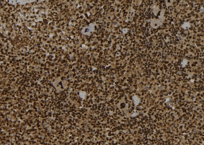 IST1 Antibody