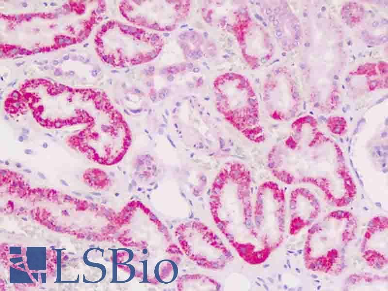 IHC-plus™ Polyclonal Rabbit anti-Human CTNNA1 / Catenin Alpha-1 Antibody (aa30-59, IHC, WB)