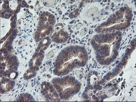 COPD / ARCN1 Antibody (clone OTI4H9)