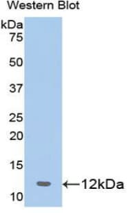 Prohibitin Antibody (aa177-272, Cy3)