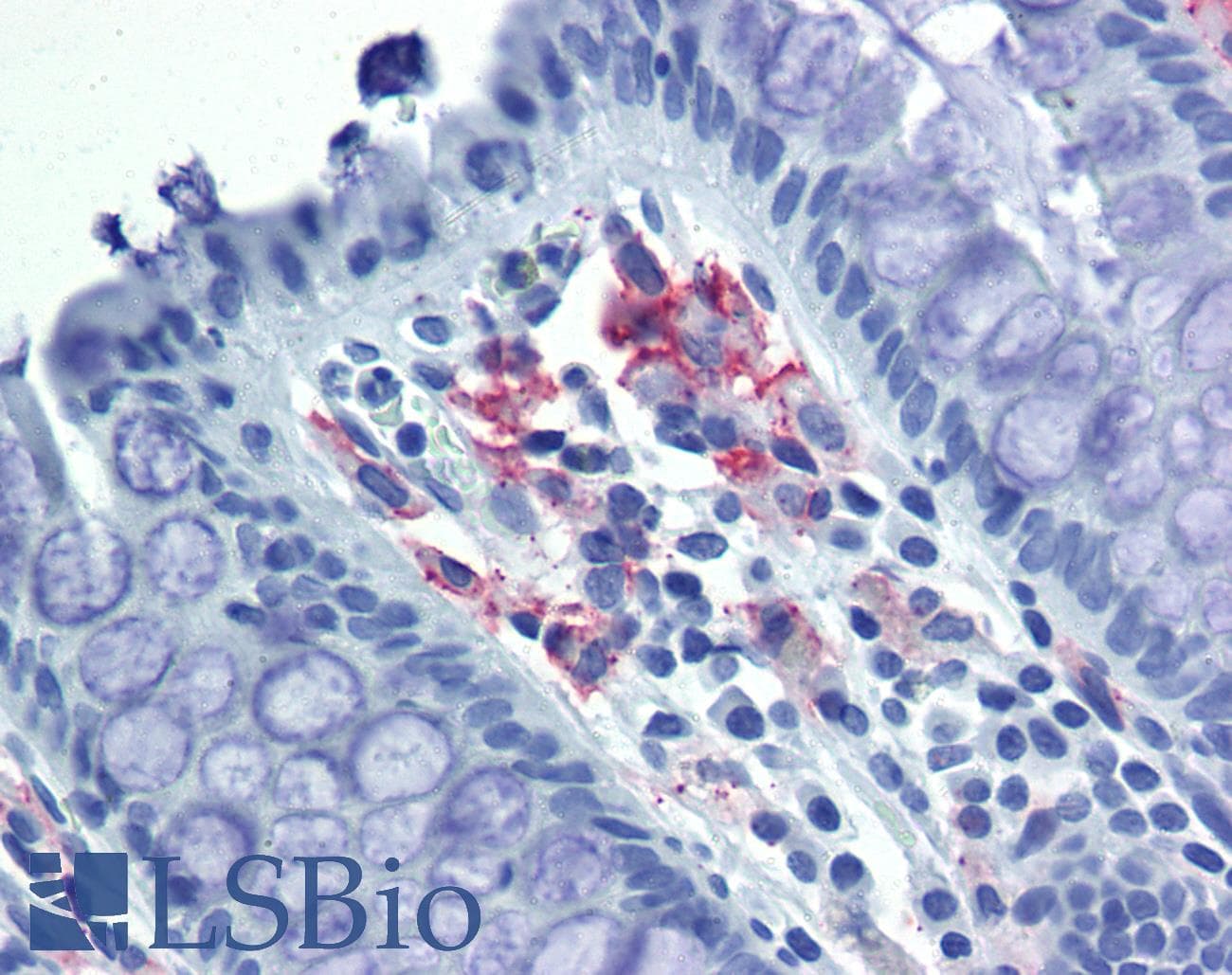 IHC-plus™ Monoclonal Rat anti-Human CD209 / DC-SIGN Antibody (clone h209, IHC)