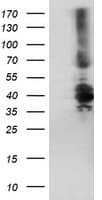 DTNB / Dystrobrevin Beta Antibody (clone OTI2E4)