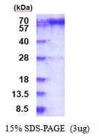 Human PREP / Prolyl Endopeptidase Protein (Recombinant His)