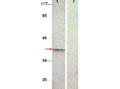 IHC-plus™ AURKB / Aurora-B Antibody (phospho-Thr232)
