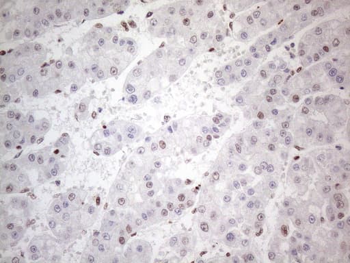 TP53BP1 / 53BP1 Antibody (aa1-300, clone OTI5E1)