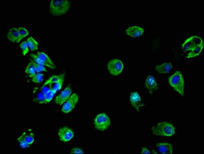 HSD17B7 / PRAP Antibody