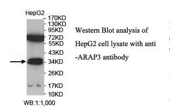 Polyclonal Rabbit anti-Human ARAP3 Antibody (aa6-204, IHC, WB)