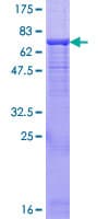 Human ENTPD3 Protein (Recombinant GST)