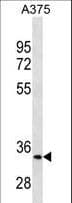 IHC-plus™ MC1R Antibody (aa205-232)