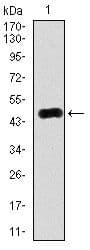Monoclonal Mouse anti-Human RAB4A / RAB4 Antibody (clone 4E+11, IHC, WB)