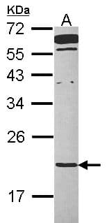 TMED2 Antibody (aa9-201)