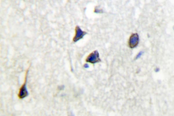ADCY5+6 Antibody (Phe1052)