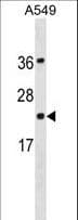 PDCD6 / ALG-2 Antibody (aa19-47)