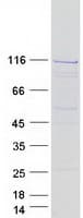 Human INTS5 Protein (Recombinant Myc-DDK (Flag))